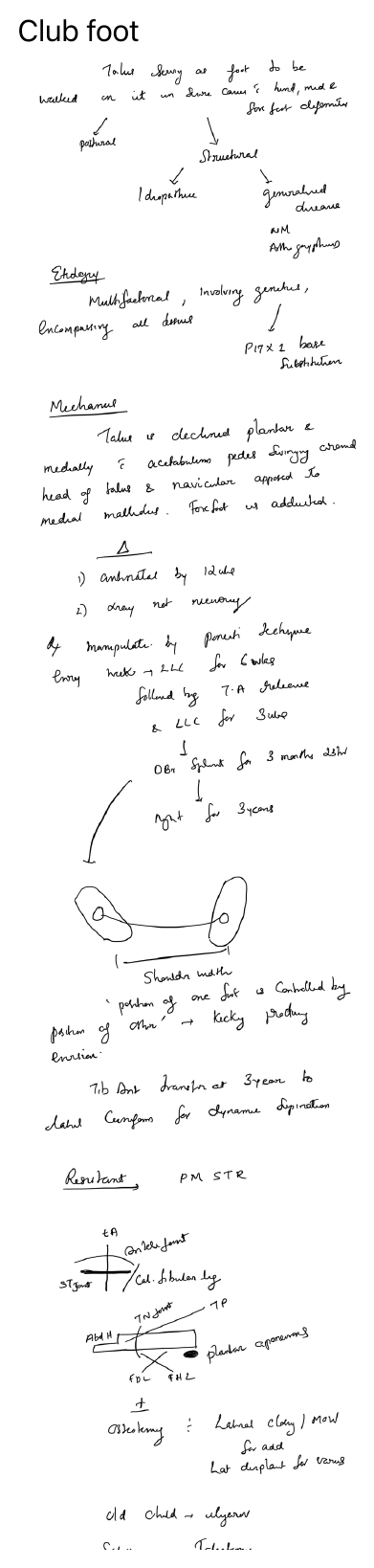 Clubfoot