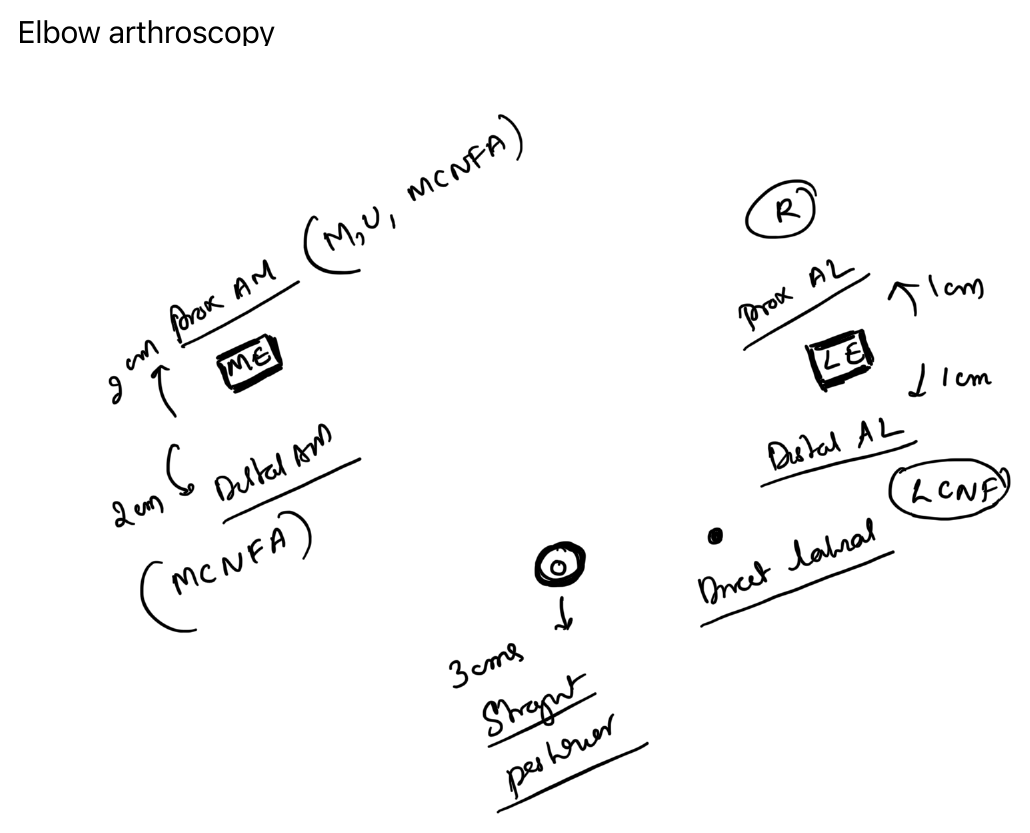 Elbow arthroscopy portals