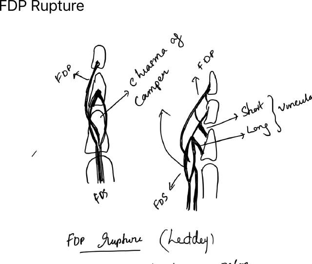 FDP anatomy