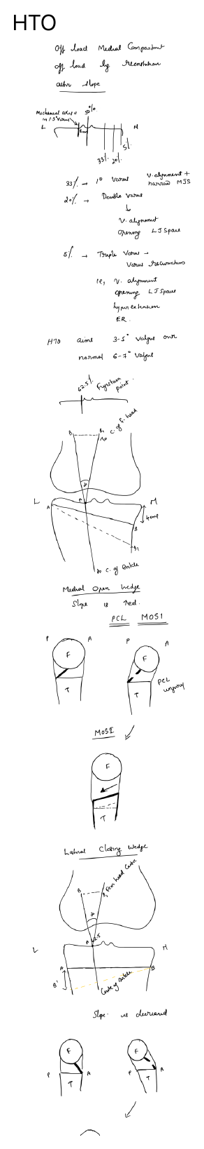 High tibial osteotomy