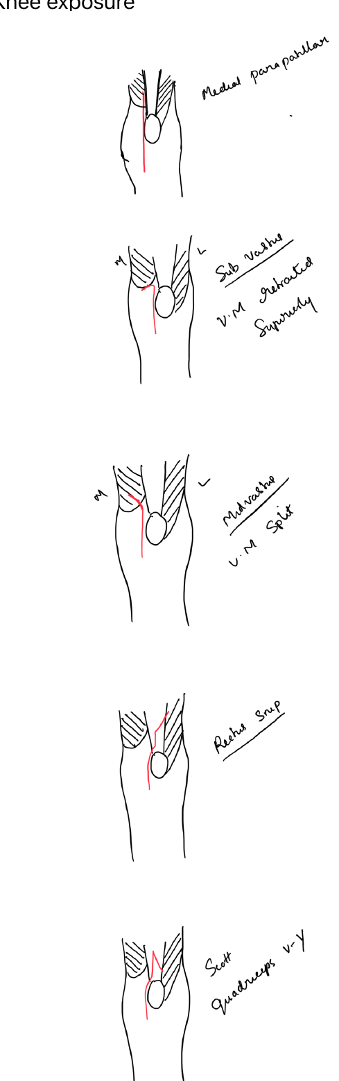 Knee exposures