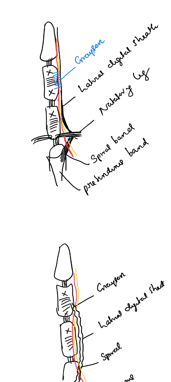 Spiral cord and neurovascular displacement