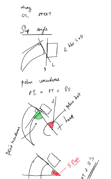 Spinopelvic parameters