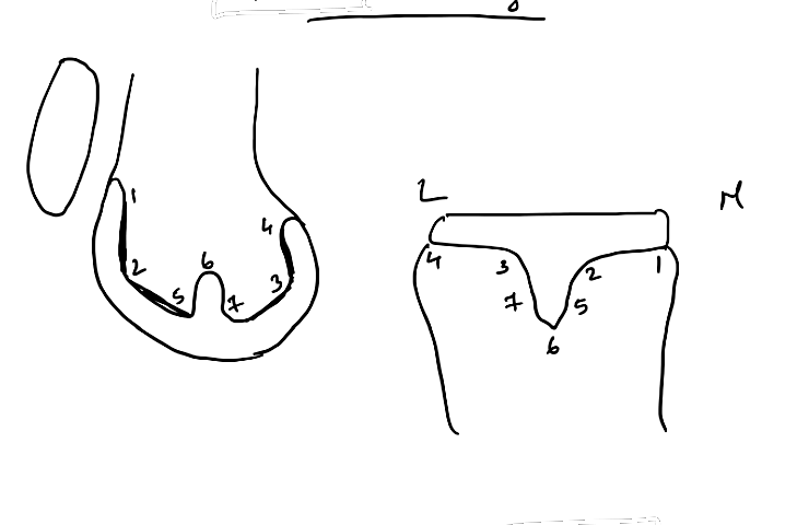 Radiographic zones around TKA components
