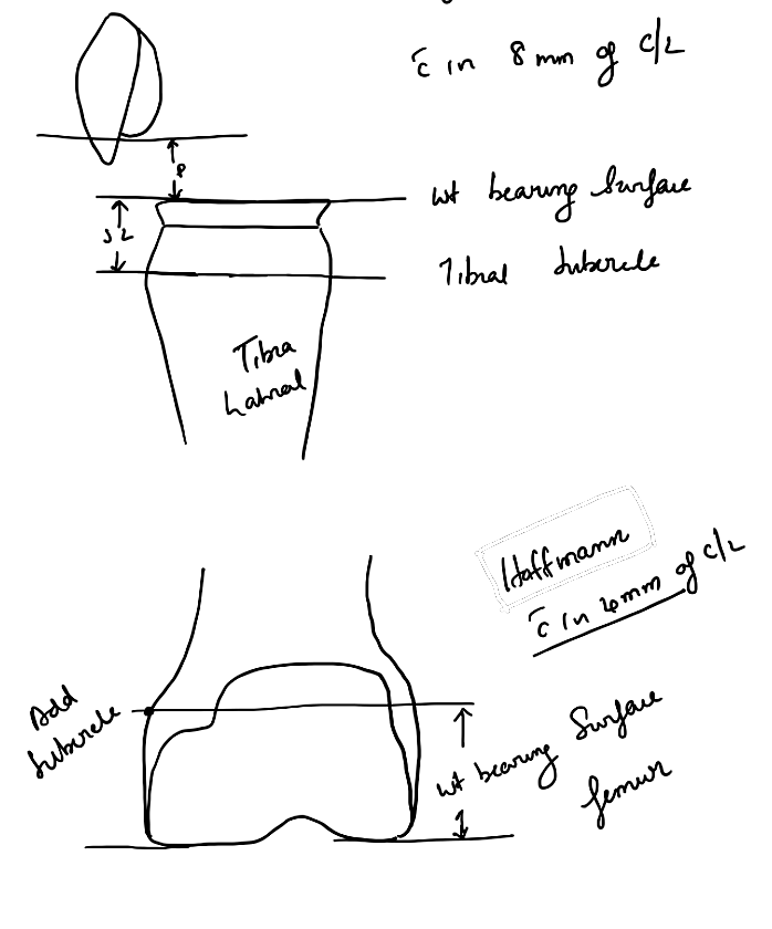 Joint-line landmarks